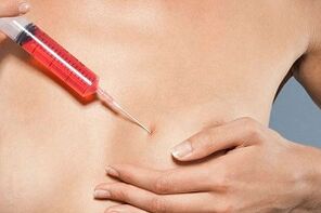 乳房注射以增加脂肪